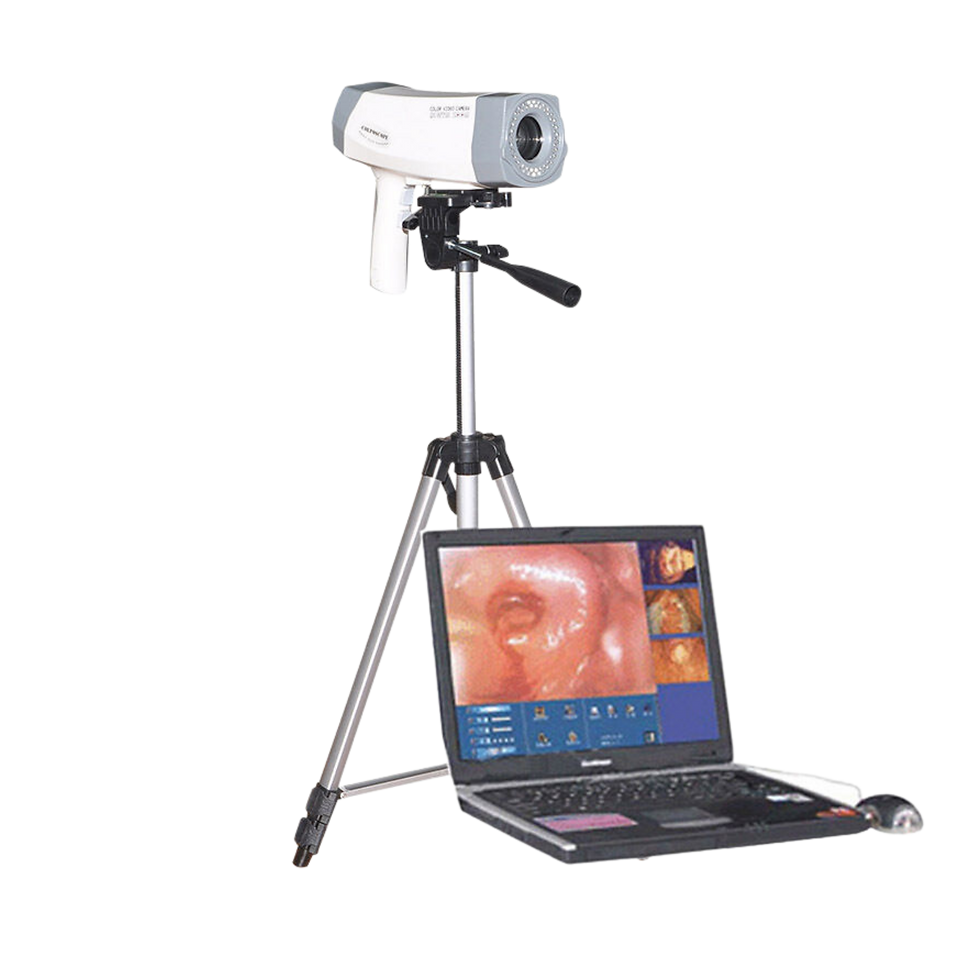 Videocolposcopio Unbranded LENS FOCUS