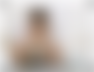 العنانة أو ضعف أو انعدام انتصاب العضو الذكري كأحد مضاعفات المرض السكري المُزمنة (E D)