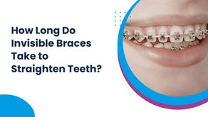 How Long Do Invisible Braces Take to Straighten Teeth?