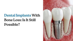 Dental Implants With Bone Loss: Is It Still Possible?