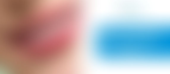 7 Signs You Might Be a Candidate for Smile Designing