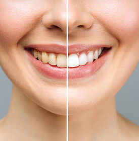istockphoto-1361598488-612x612.jpg