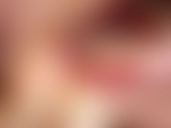 مشاكل الفم عند مرضى السكري: الوقاية والعناية اليومية