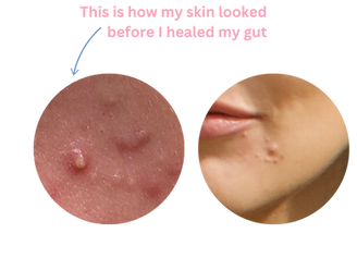 Skin healing_edited.png