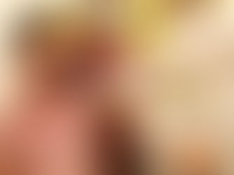 Vacinação contra a Dengue em Jaboatão começa para crianças de 10 a 11 anos