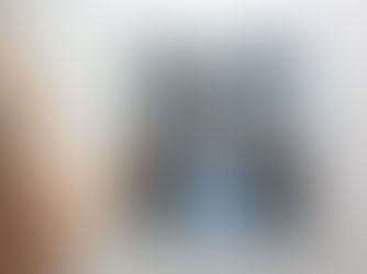 Mutirões de ultrassonografias e raios-X agilizam exames em Jaboatão dos Guararapes