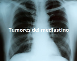 Radiografia de un paciente con tumor del mediastino anterior