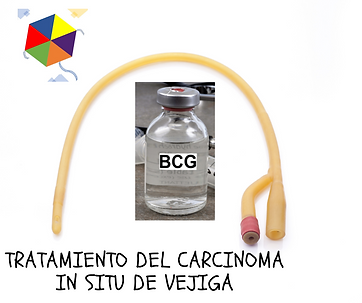 Sonda de foley a punto de ser colocada por un personal de salud