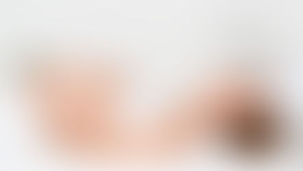 A woman receiving Hypnotherapy for Childbirth