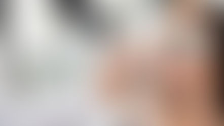 【2020年版】医療レーザー脱毛機２強を比較