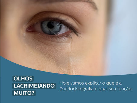 OLHOS LACRIMEJANDO MUITO? Hoje vamos explicar o que é a Dacriocistografia e para que serve