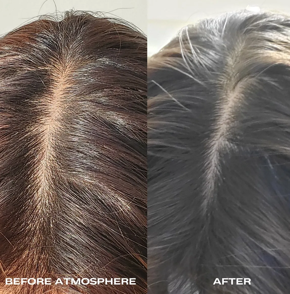 Thumbnail: Luna Nectar Hair Density& Scalp Serum