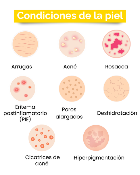 Condiciones de la piel tratadas en una Asesoría Cosmética Personalizada: arrugas, acné, rosácea, eritema postinflamatorio, poros alargados, deshidratación, cicatrices de acné e hiperpigmentación.
