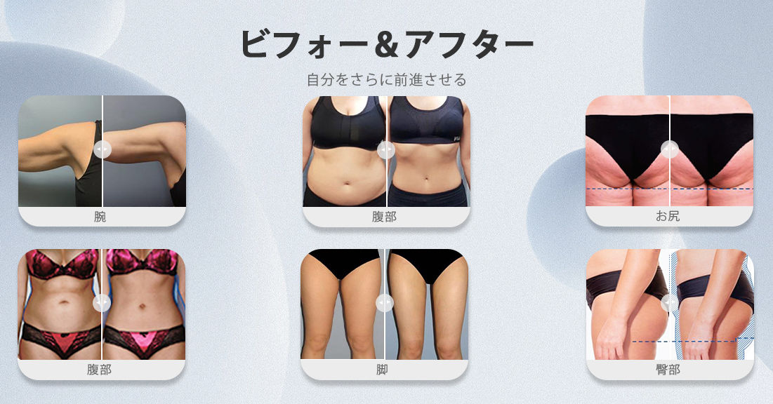 痩身 マシン 業務 用