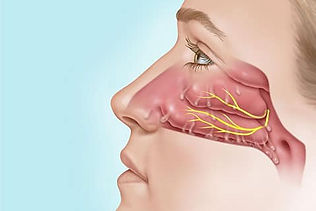 Nasal Cavity with Chronic Rhinitis