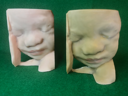 3D Sonogram Printed Sculpture