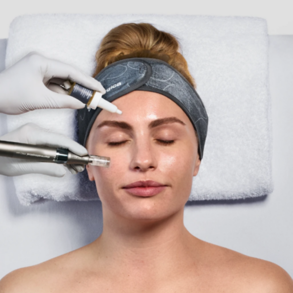 Microneedling and Exosomes.png