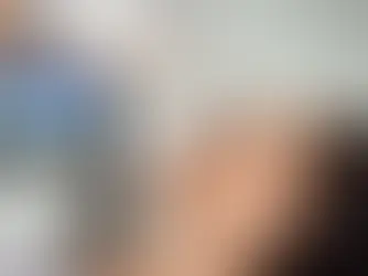 Unlock the secret to a more radiant, smoother skin with the Harmony XL PRO iPixel laser resurfacing treatment.