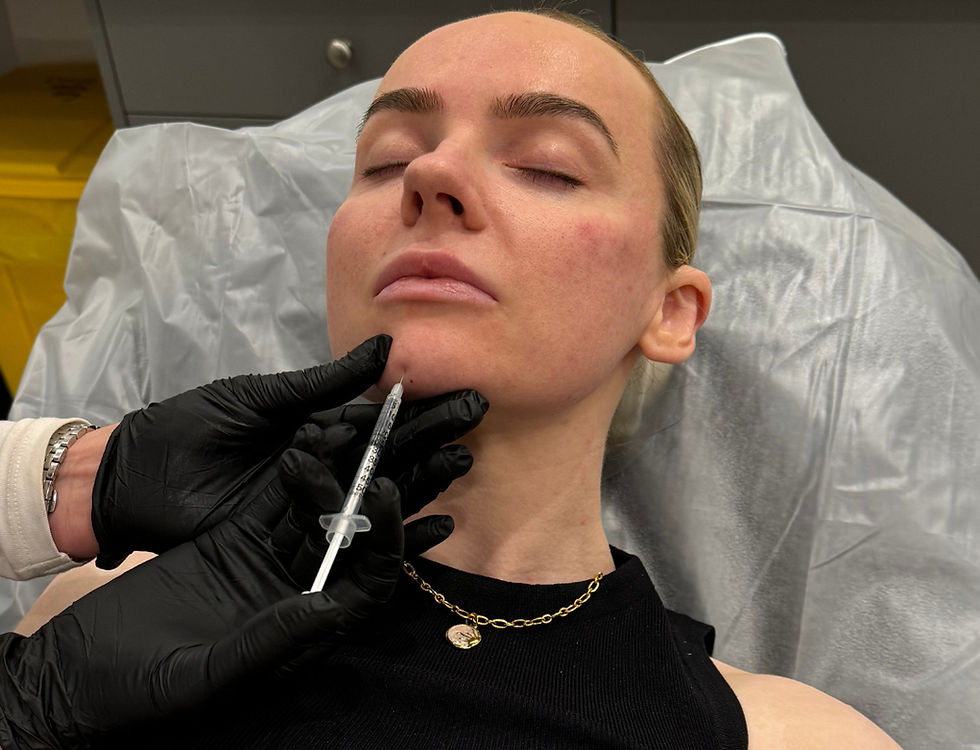 Close-up view of a syringe with dermal filler solution