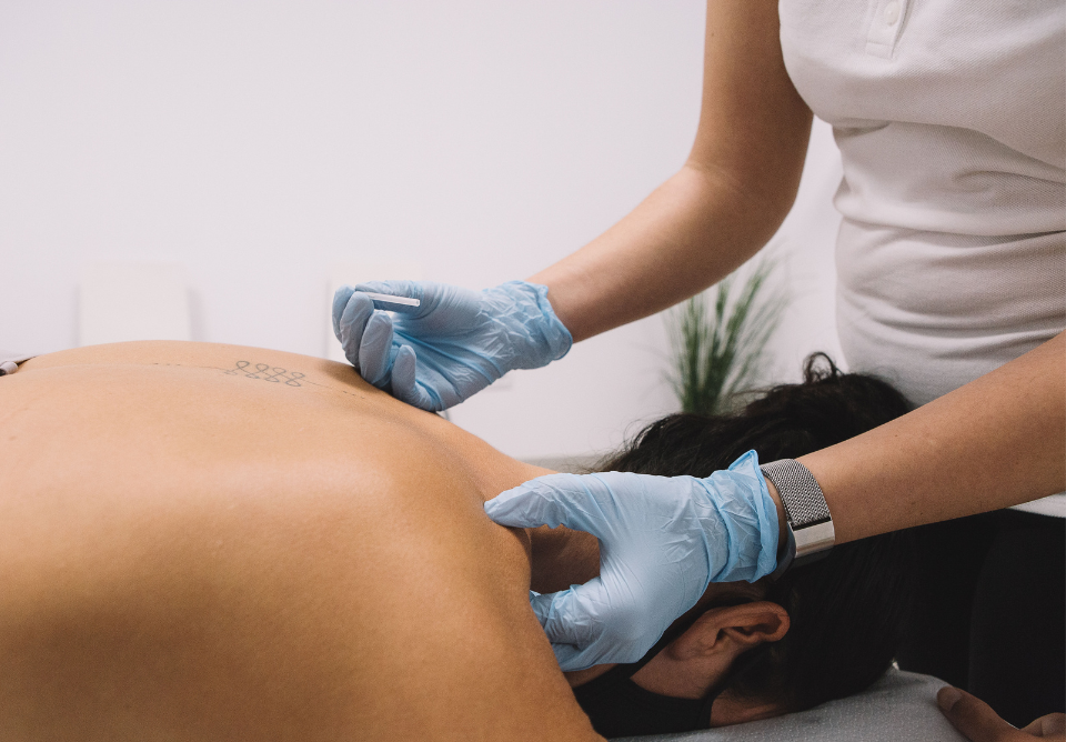 Cupping (960 x 668 px) (1).png