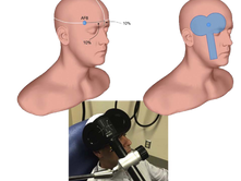Essa maneira de explicar a depressão pode "fazer sentido" aos pacientes e ainda guiar o tratamento