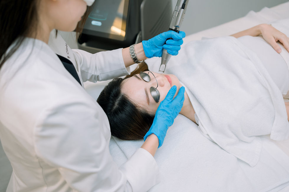 Doctor performing Q-switched laser treatment for post-acne hyperpigmentation in Singapore