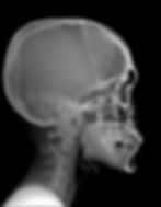 human-head-with-skull-middle_edited_edited.jpg