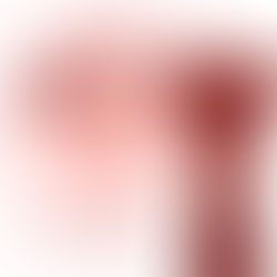 A endometriose precisa necessariamente de cirurgia?