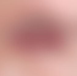 Como evitar o refluxo do bebê?