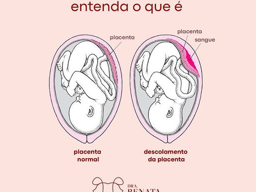 Descolamento de placenta: entenda o que é