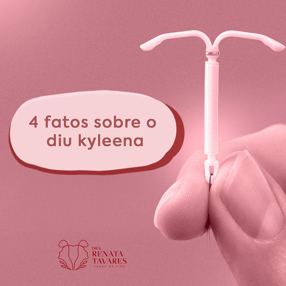4 fatos sobre o DIU Kyleena