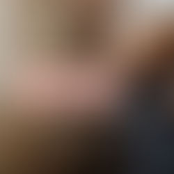 Pré-eclâmpsia: hipertensão na gravidez