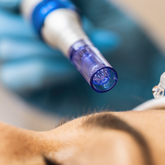 Microneedling