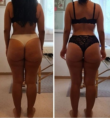 IMG-20210819-WA0047 donja.jpg