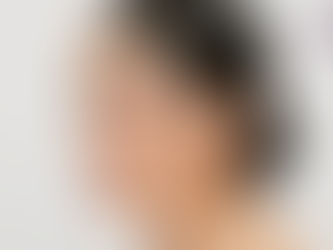 Melasma Treatment in Kolkata: What Actually Works for Indian Skin