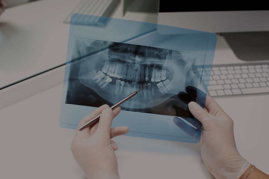 dentist-analyzes-x-ray-photo.jpg
