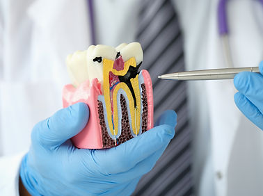 doctor-dentist-showing-pen-carious-cavity-artificial-plastic-model-tooth-closeup.jpg