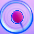 In Vitro Fertilization
