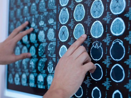 Chercheuse en neurologie 