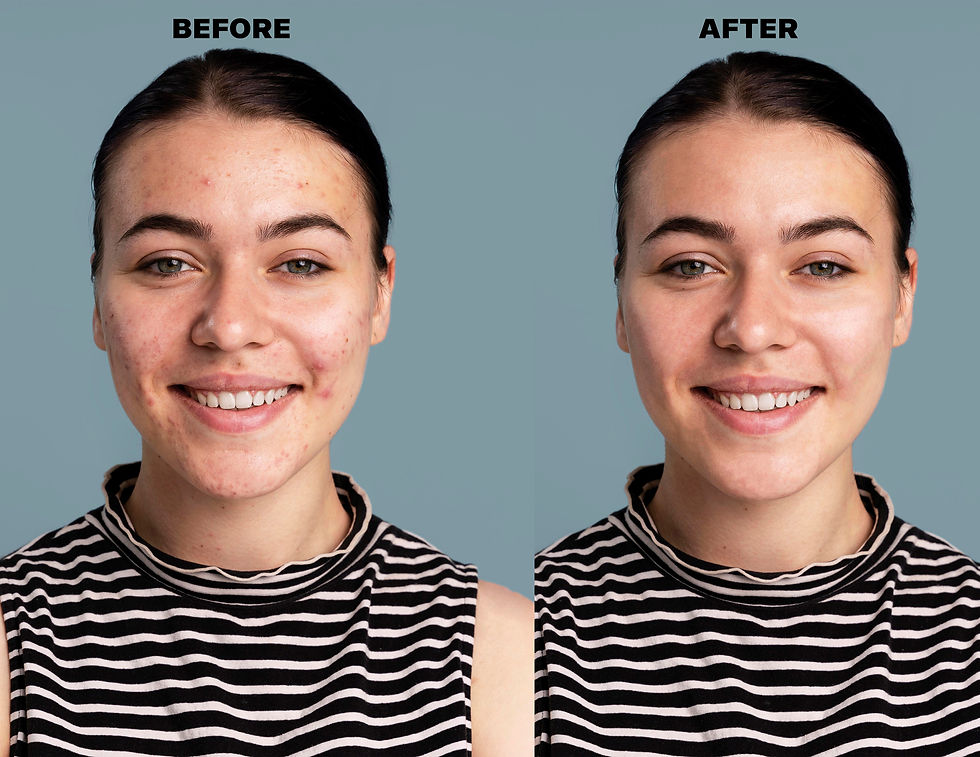 FACE RETOUCH 2