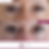 Lower eyelid improvement and cheek depression improvement.