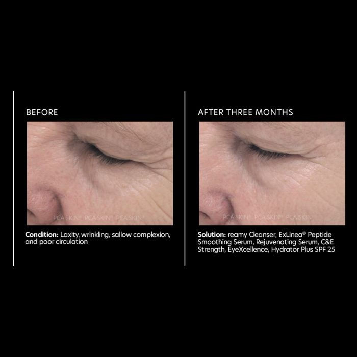 Thumbnail: PCA ExLinea® Peptide Smoothing Serum