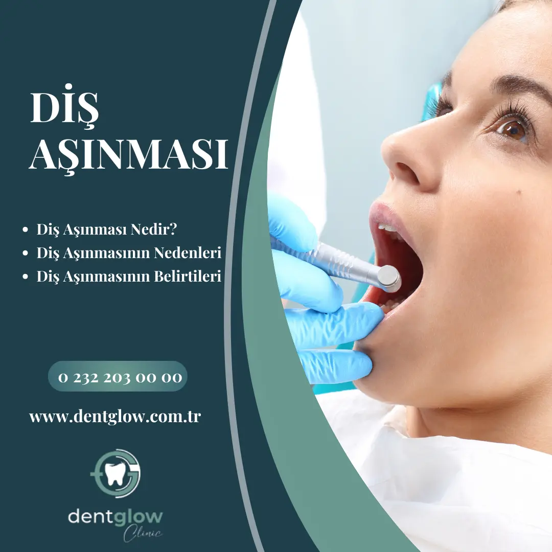 Genç Yaşta İmplant Yapılır mı? genç yaşta implant yaptiranlar kadınlar kulübü