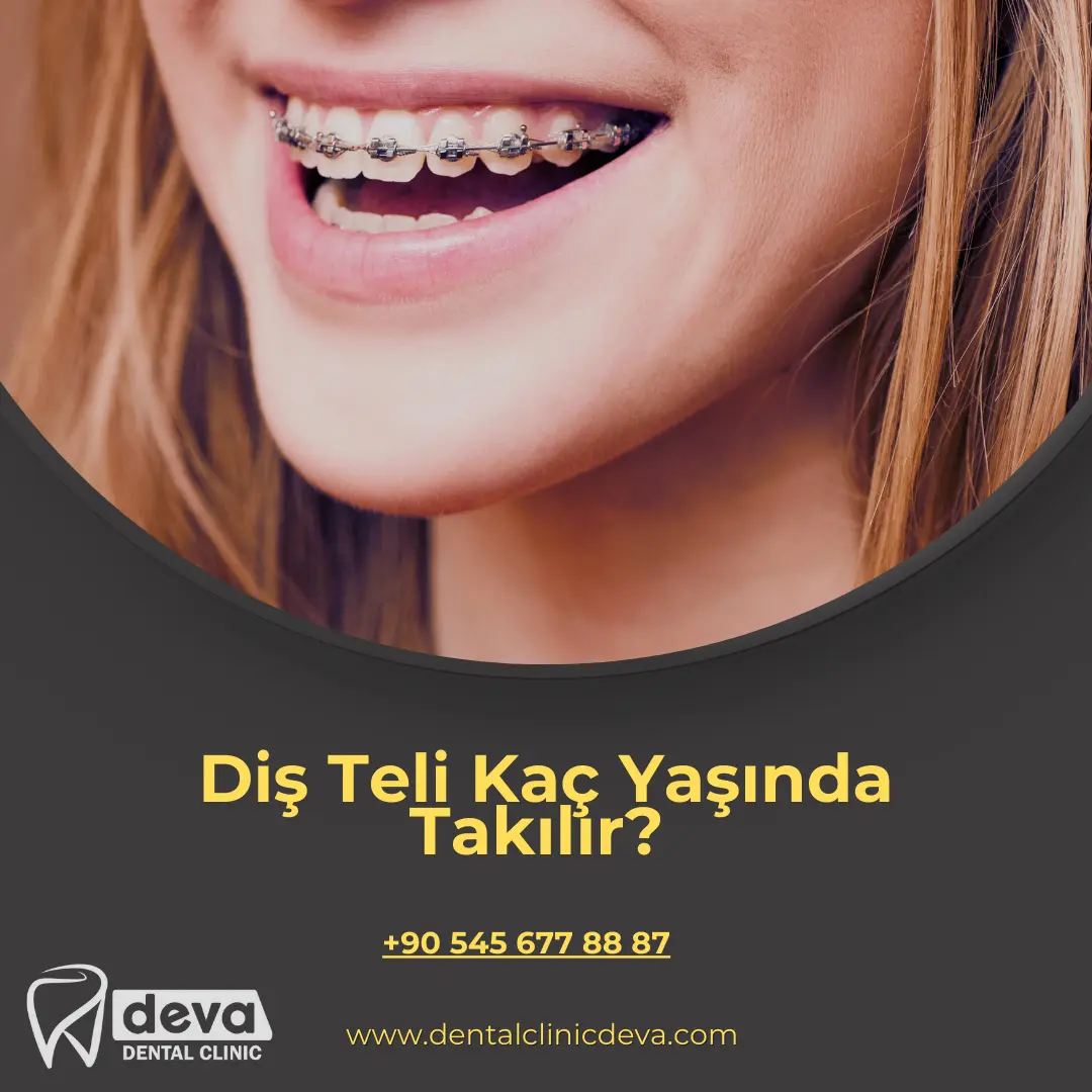  ayrık diş