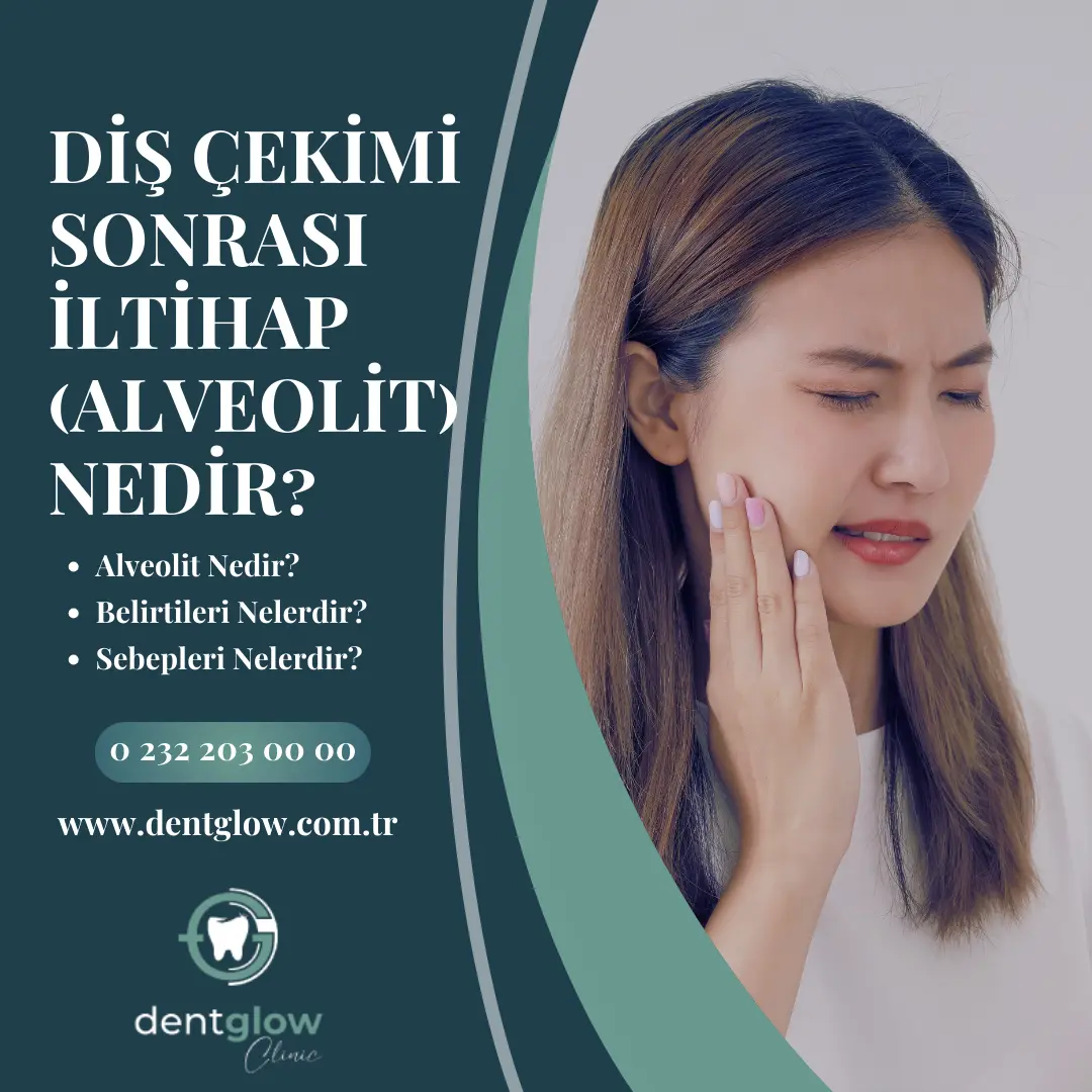 Gripken diş çekilir mı Kadınlar Kulübü