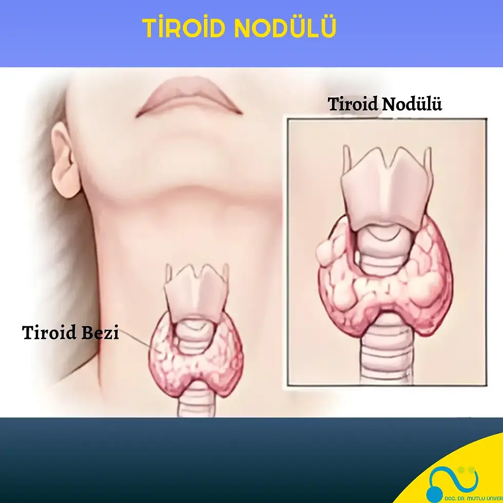 Tiroid nodülü kaç mm ameliyat gerekli