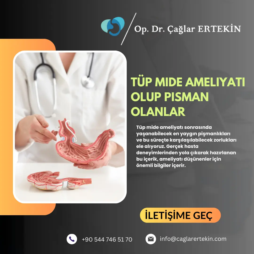 Mide balonu taktiranlar Kadınlar Kulübü
