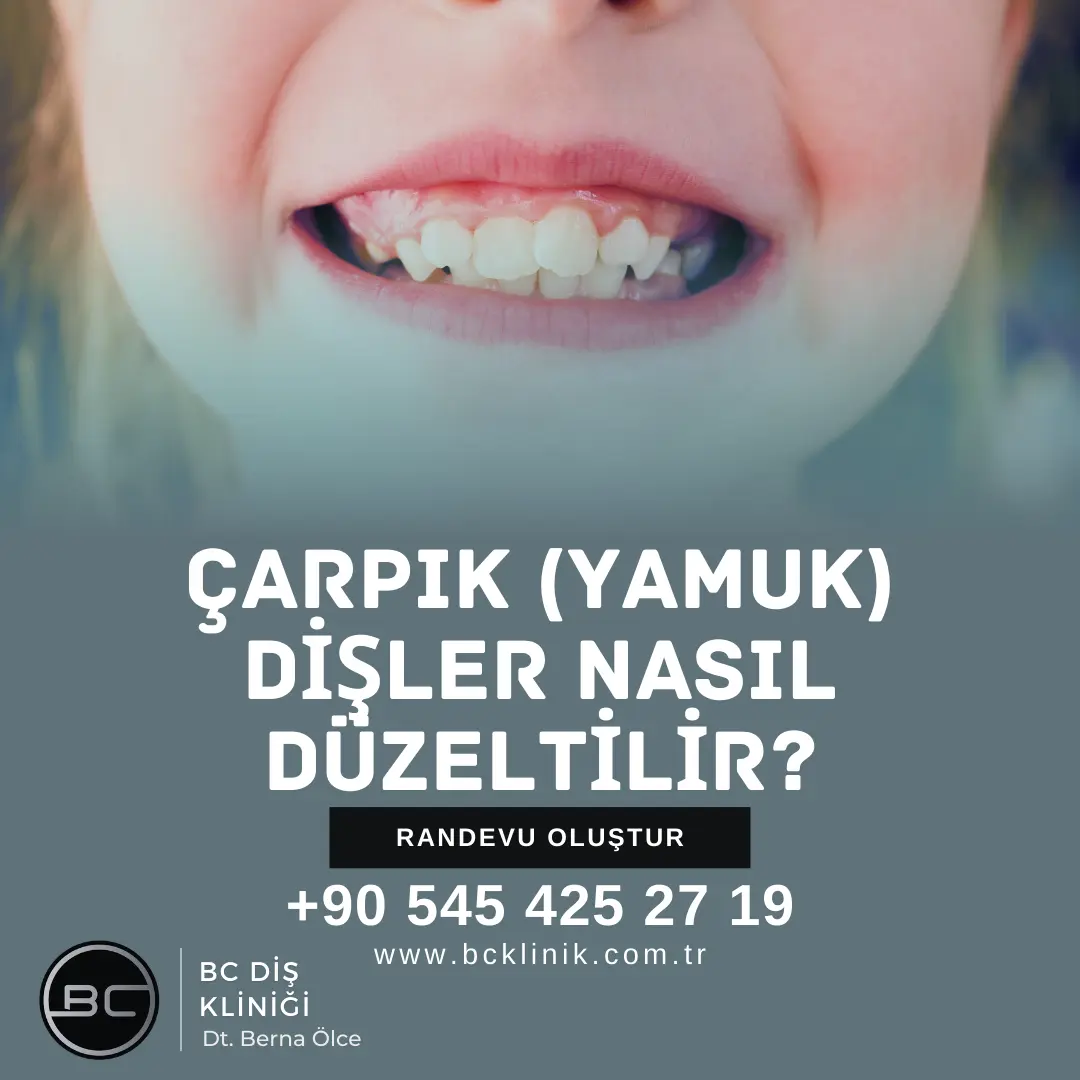  kanal tedavisi sonrası zonklama