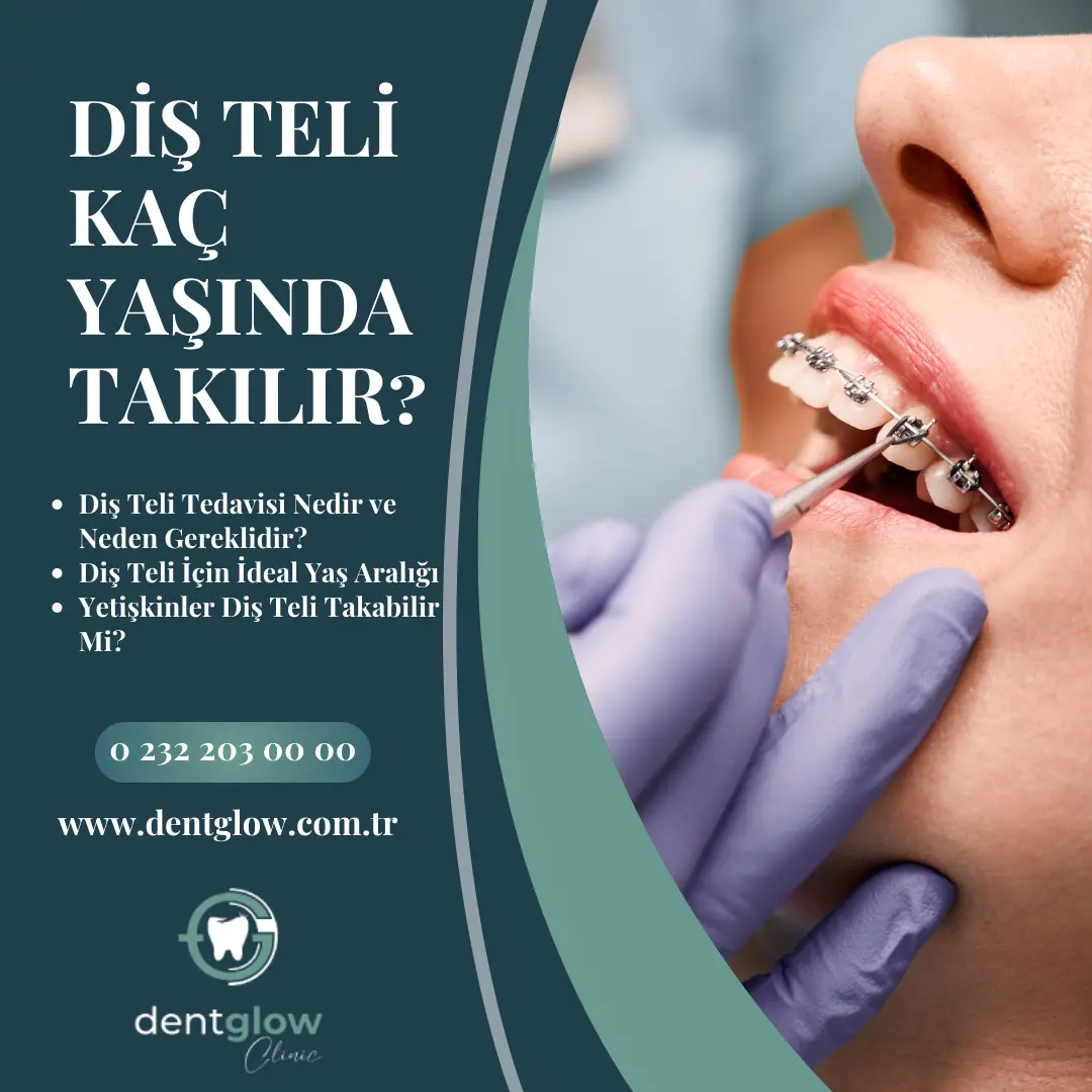 20 lik diş çekimi sonrası komplikasyonlar