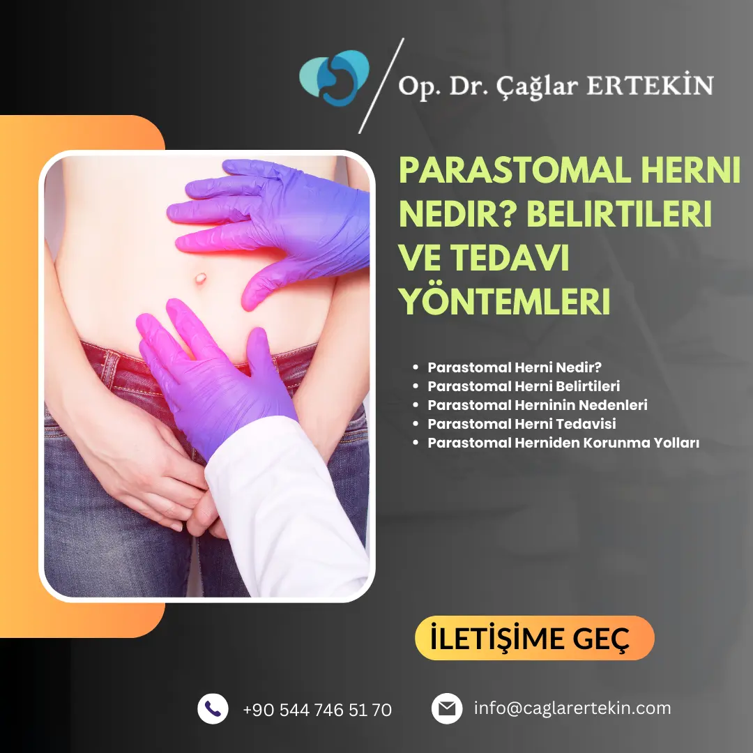 bağırsak düğümlenmesi